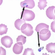 Illustration for article titled New Method for Fighting Malaria: Enlist Gamers